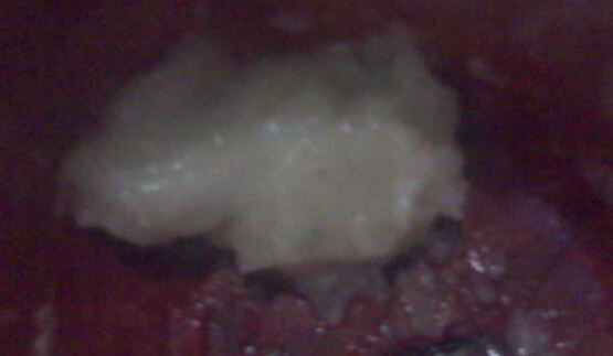 маринованная свекла по-грузински